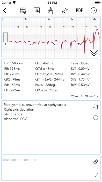 ECG / EKG screenshot-4