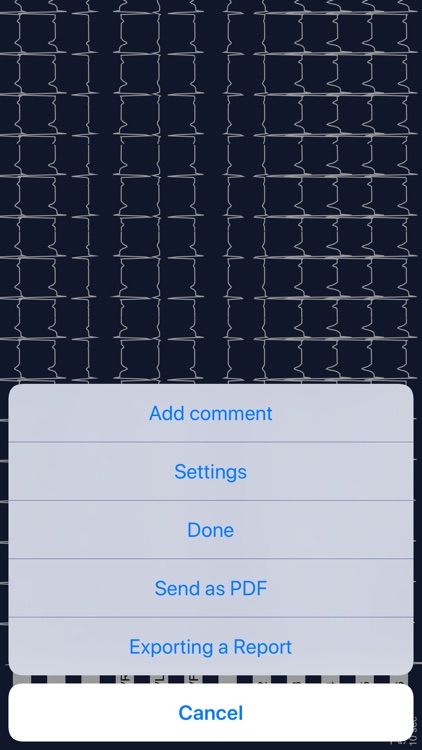 Multi-ECG screenshot-3