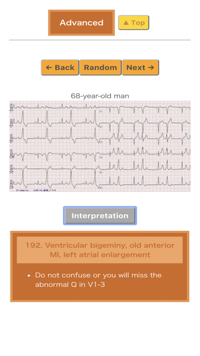 Pocket ECGのおすすめ画像5