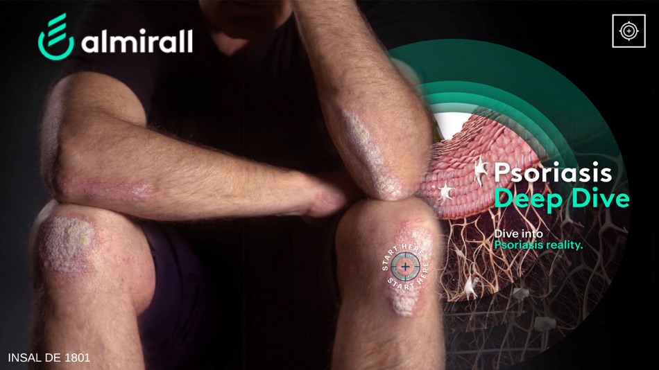 #1. Psoriasis Deep Dive (iOS) 由: Almirall SA