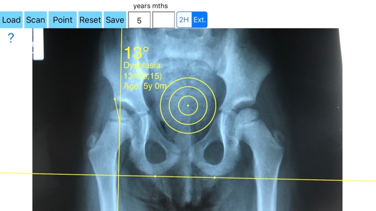 CenterEdgeAngleApp screenshot-4