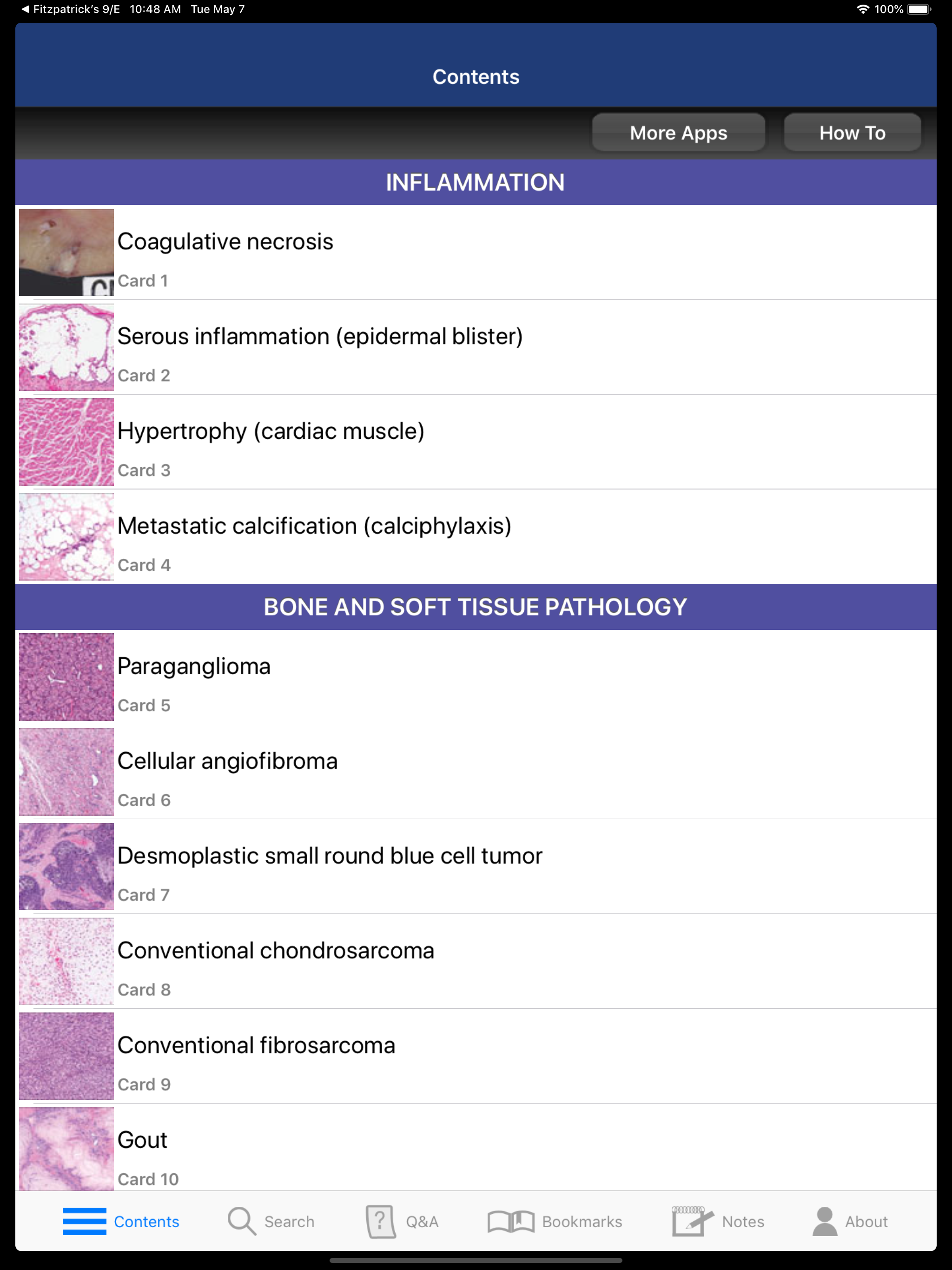Anatomic Pathology Flashcards