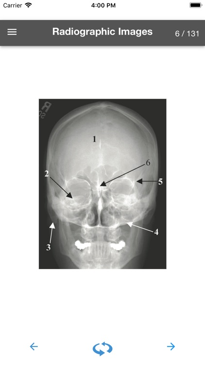 Rad Tech - Radiographic Images