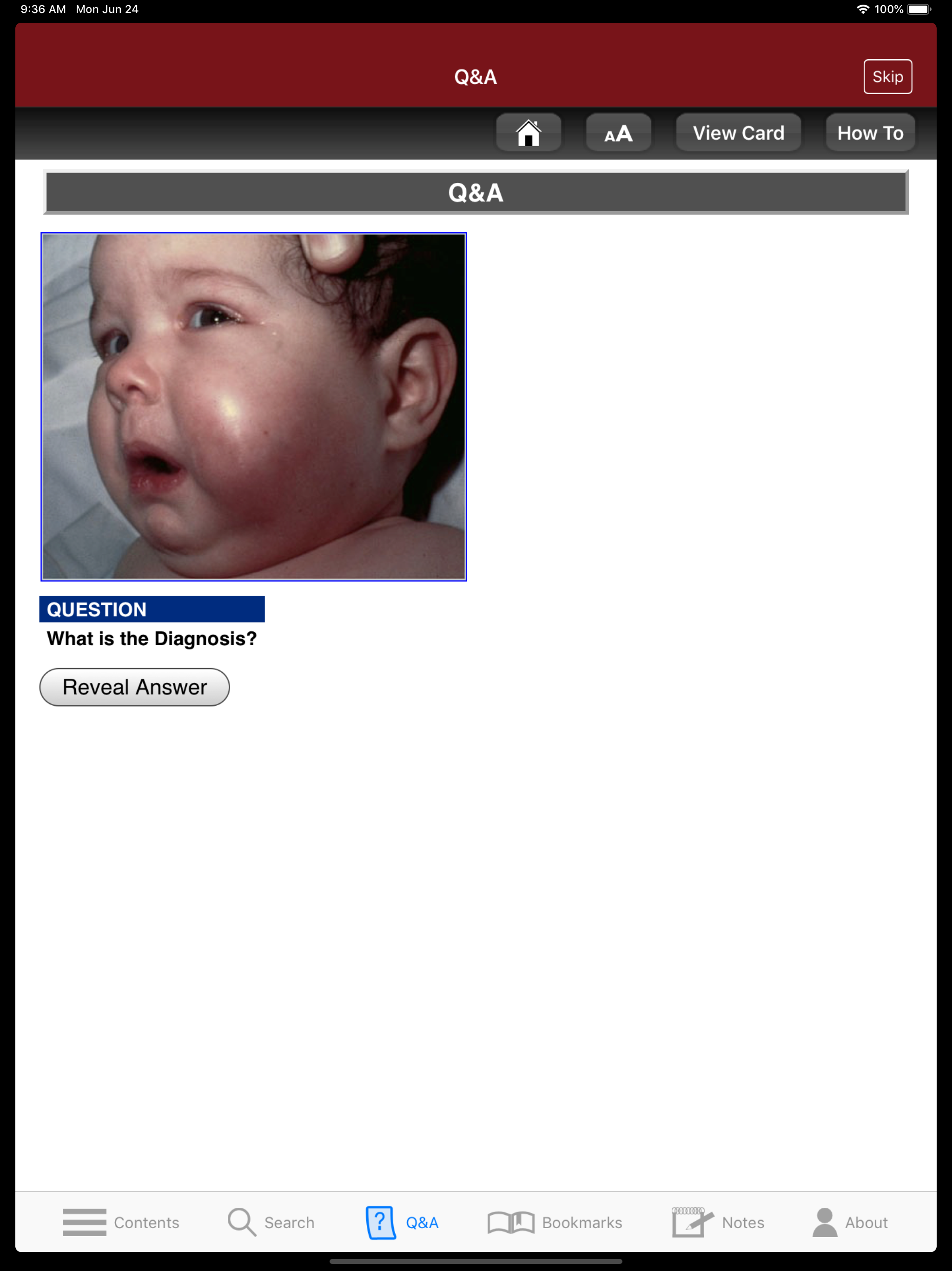 The Atlas of ER Flashcards