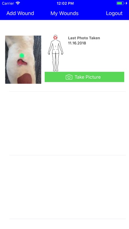 MobileWoundCare for Patients