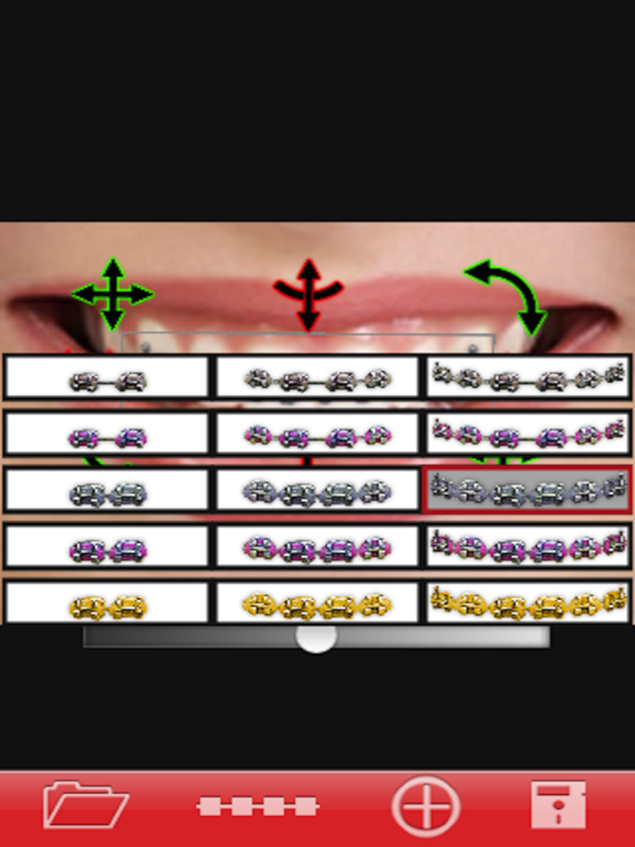 Orthodontic