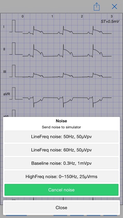 Screenshot #3 pour ECG Simulator