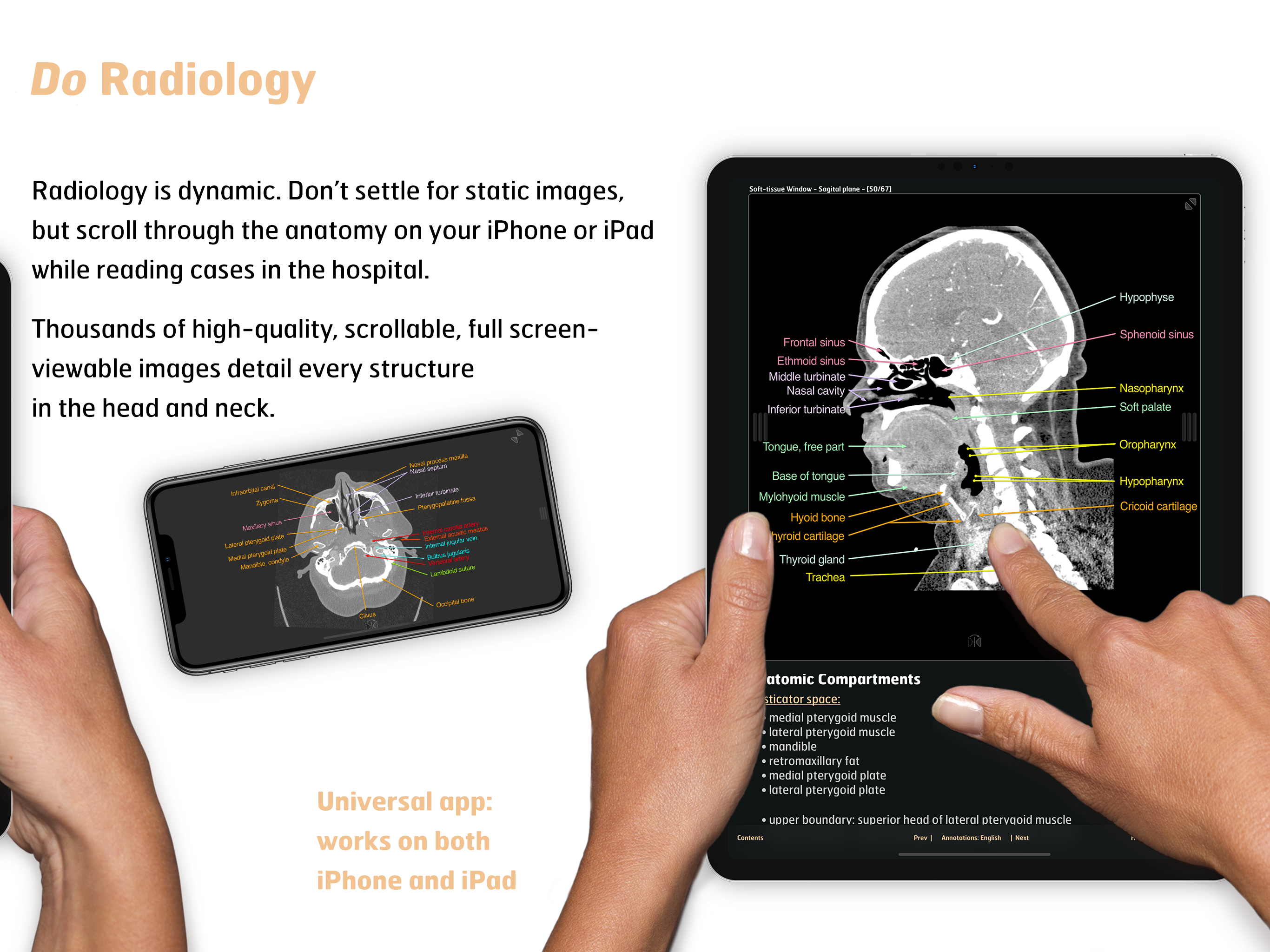 Radiology - Head&Neck Anatomy screenshot 7