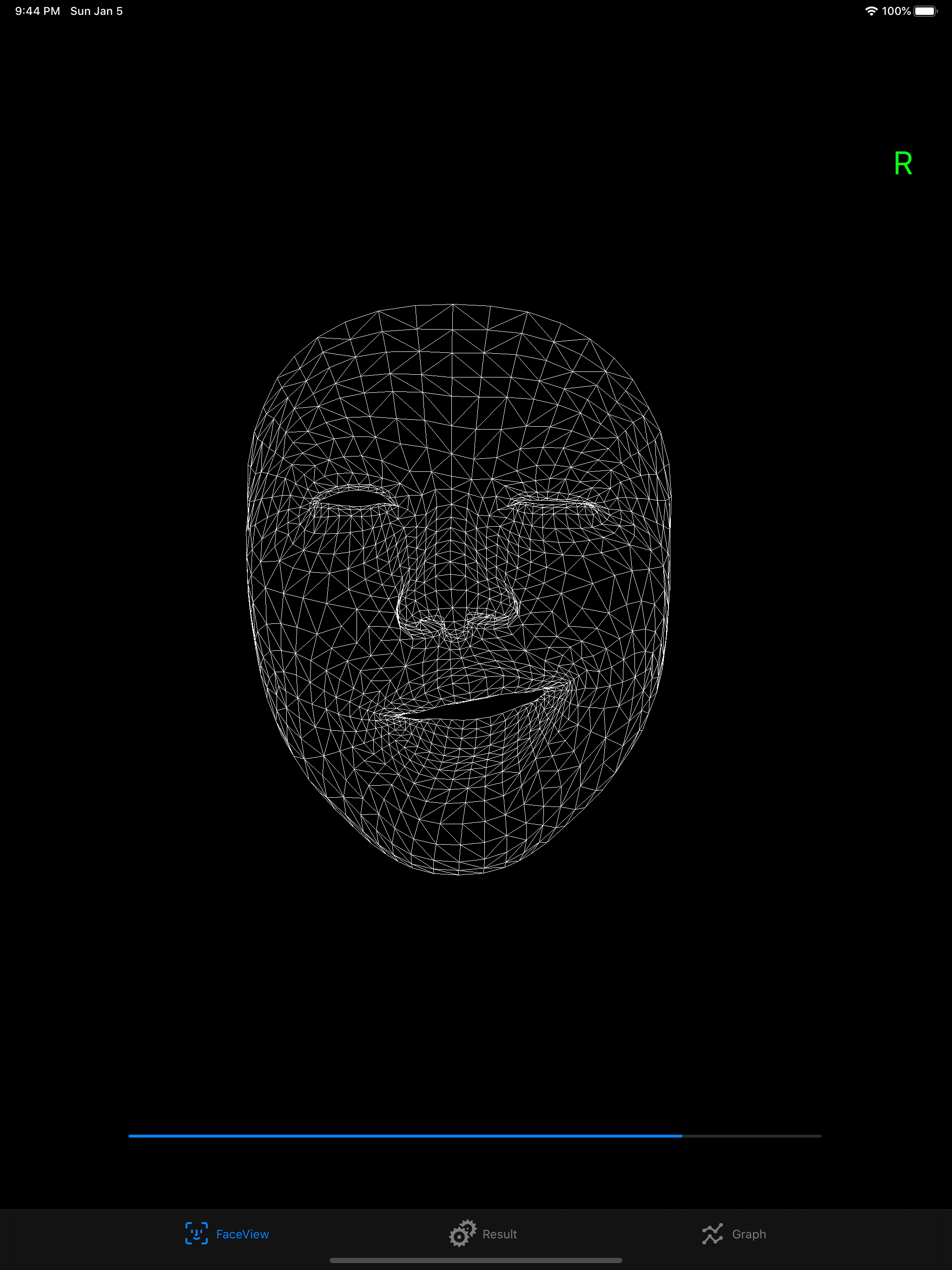 FacialPalsyZero screenshot 3