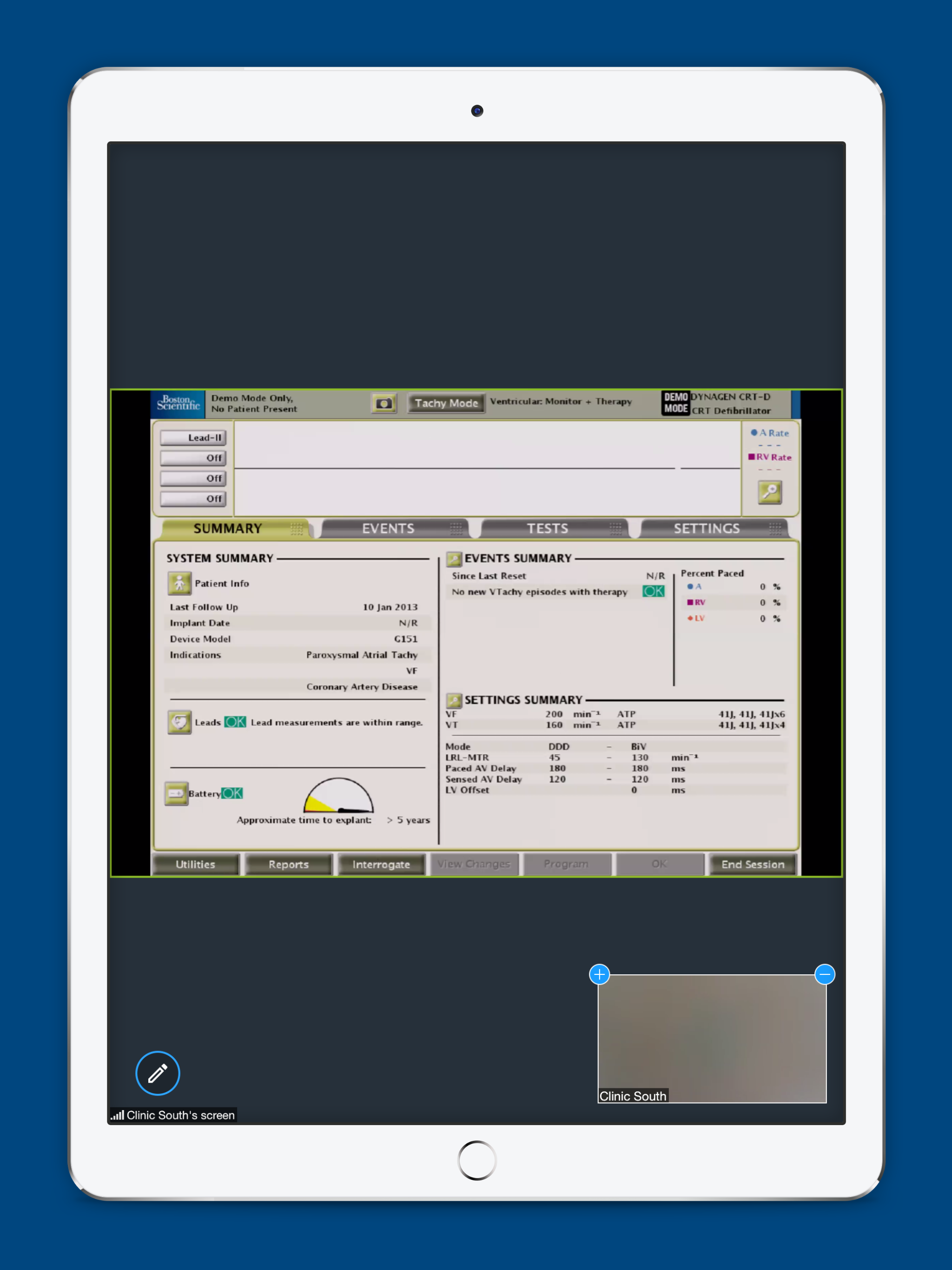 Heart Connect Remote Software screenshot 8