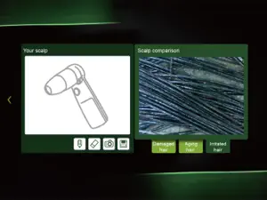 Scalp Analyzer screenshot #5 for iPad