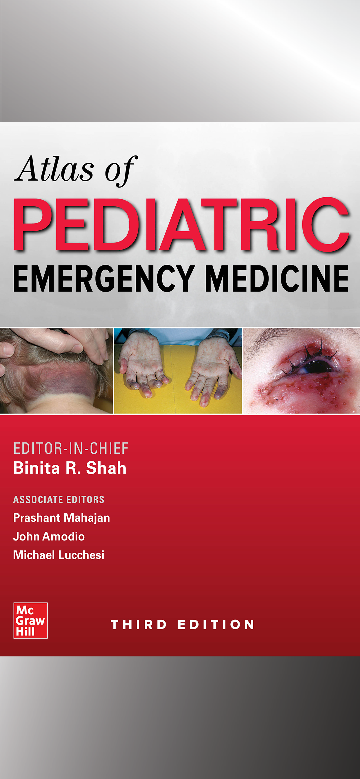 Atlas of Pediatric ER Med, 3/E
