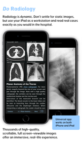 Radiology - Thoracic Imaging screenshot