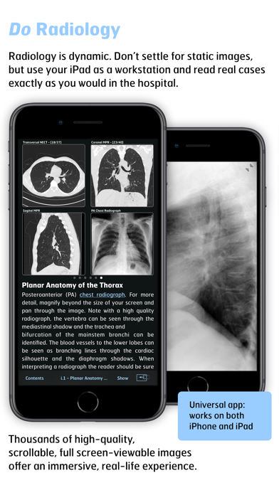 Screenshot #3 pour Radiology - Thoracic Imaging