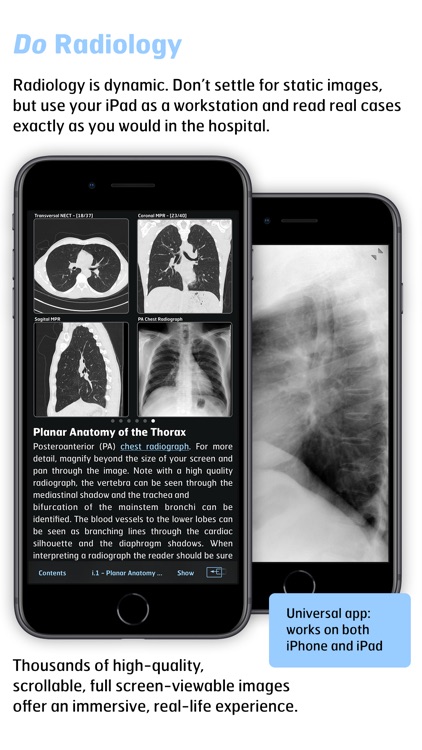 Radiology - Thoracic Imaging