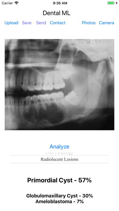 Dental ML Screenshot