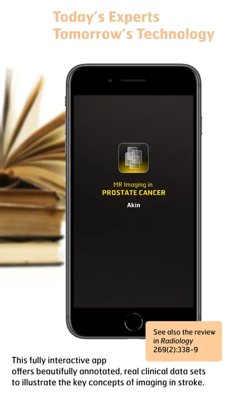 Radiology - Imaging in Stroke screenshot 1 of 5