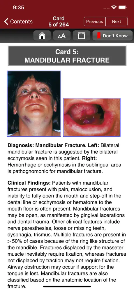 The Atlas of ER Flashcards