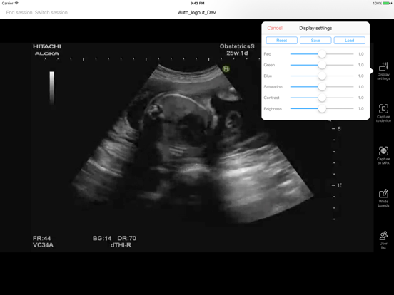 RMTConnect iPad screenshot 4 - Medical app