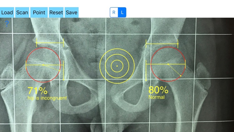 CongruityIndex screenshot-4