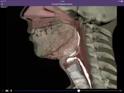 dysphagia ipad images 3