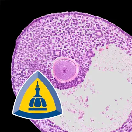 Ovarian Tumor Pathology Cheats