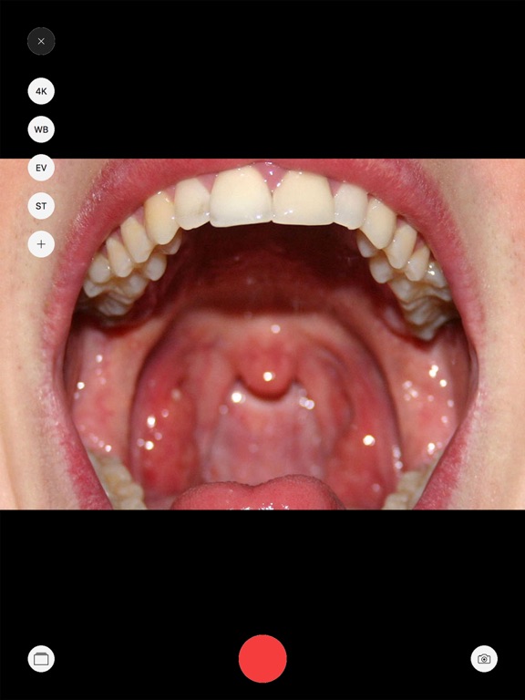 Screenshot #6 pour OXO 4K