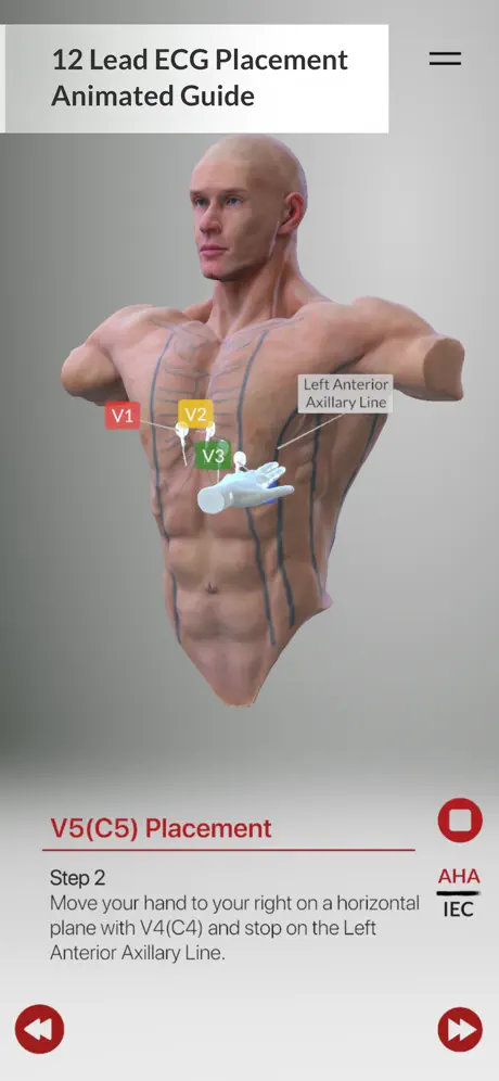 3D ECG Leads