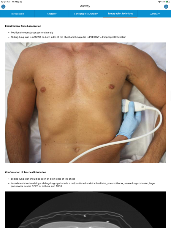 Screenshot #5 pour SonoSim