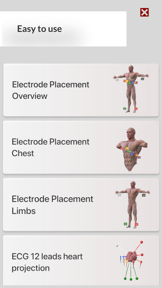 3D ECG Leads screenshot