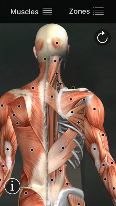 Screenshot #1 pour Muscle Trigger Points