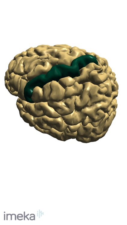 NeuroNavigator screenshot-5