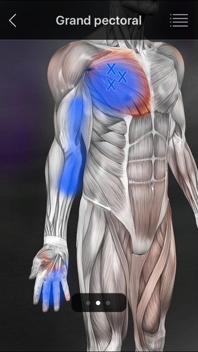 Screenshot #2 pour Muscle Trigger Points