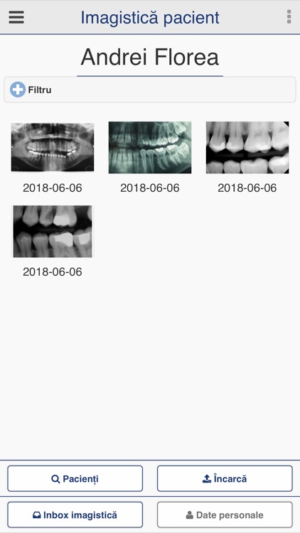 ddx Ray screenshot-3