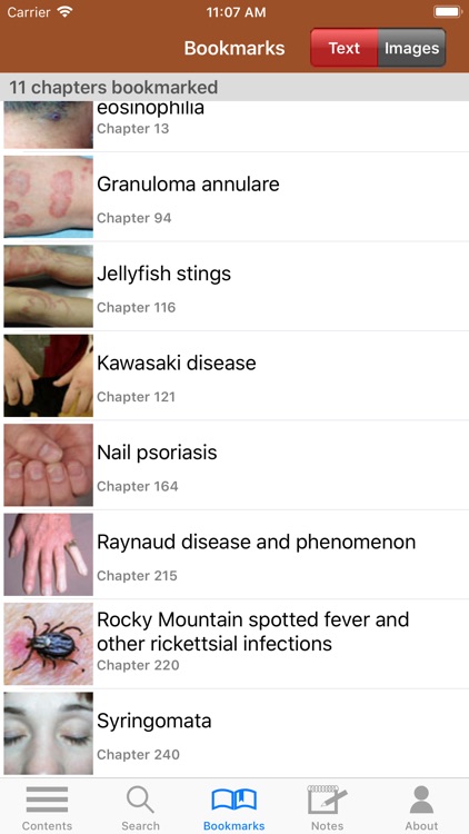 Treatment of Skin Disease, 5/E screenshot-9