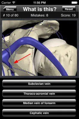 Game screenshot Anatomy Shoulder Quiz hack