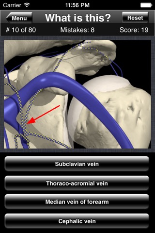 Anatomy Shoulder Quizのおすすめ画像3