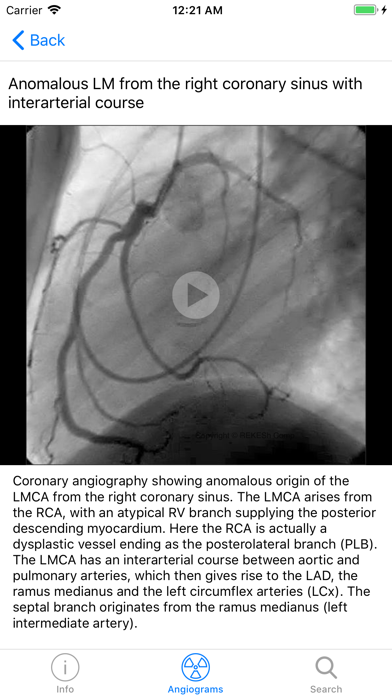 Screenshot #2 pour CARDIO3® Interventional Atlas