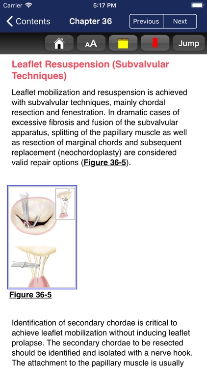Cardiac Surgery in Adults, 5/E screenshot-9