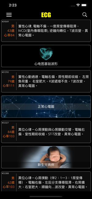 ECG / EKG(圖2)-速報App