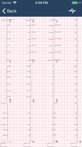 ECG Guideのおすすめ画像3