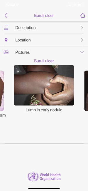 Skin NTDs App(圖4)-速報App