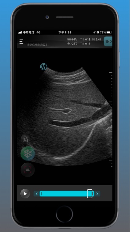 Aco Apache Ultrasound App