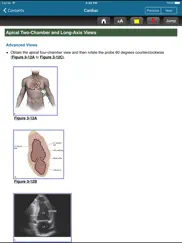 atlas emergency ultrasound, 2e ipad bildschirmfoto 4