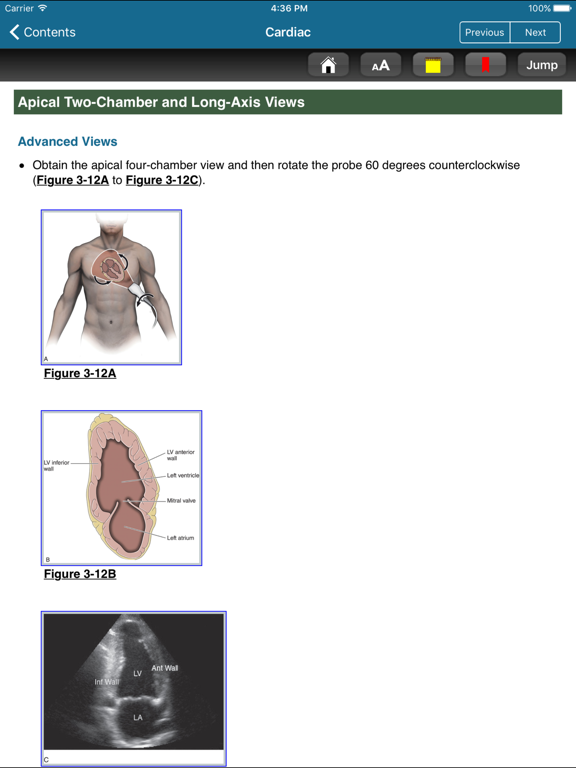 Atlas Emergency Ultrasound, 2E iPad screenshot