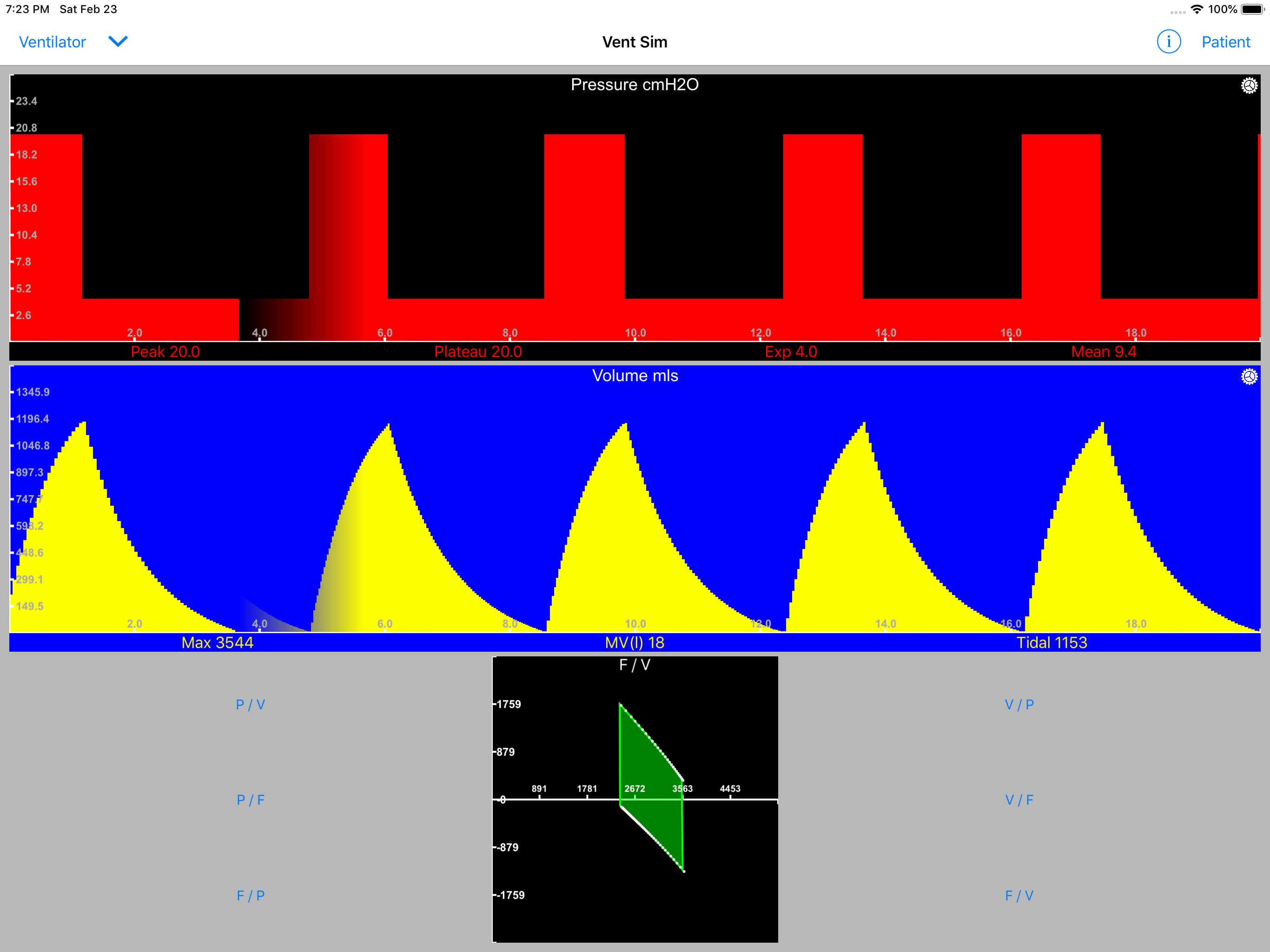 VentSim screenshot 15