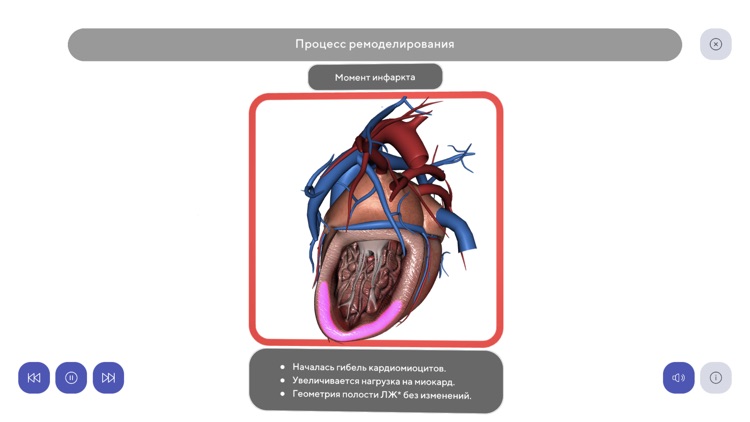 AR Cardio для визитов SF