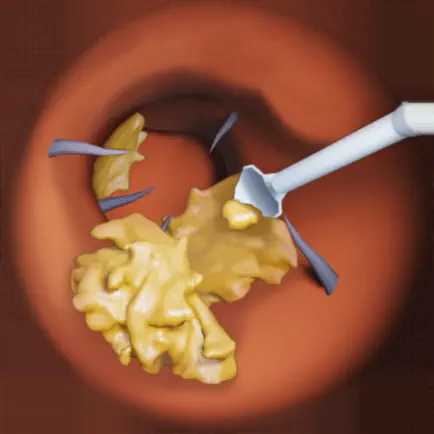 Endoscope cleaning ear Читы