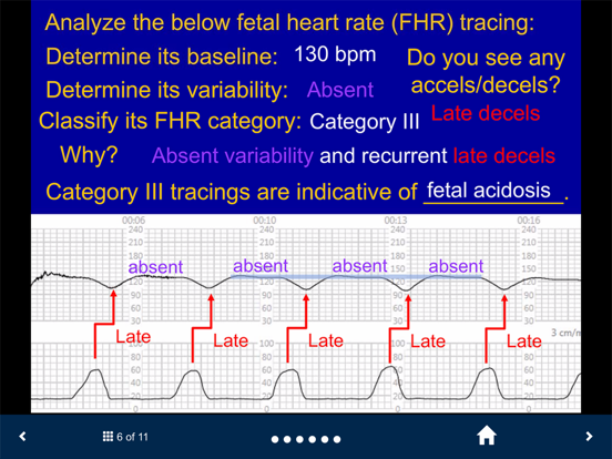 Fetal Heart Rate - SecondLook iPad screenshot 5 - Medical app