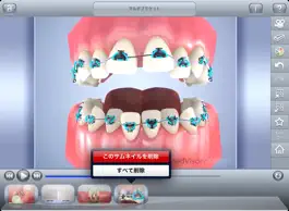 Game screenshot MedVisor Dental apk